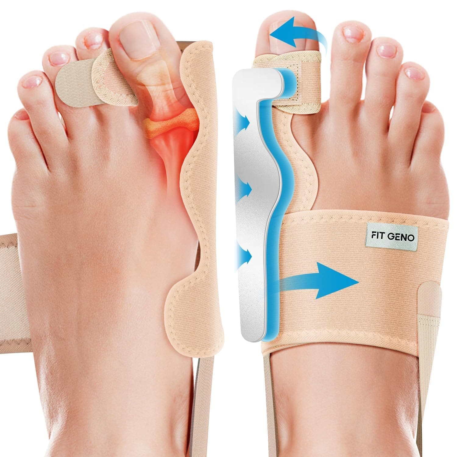 Fit Geno Corrector de juanetes para mujeres y hombres – Separador de dedo gordo ajustable para aliviar el dolor – Corrector ortopédico de dedos para Hallux Valgus – Soporte día y noche – 1 par